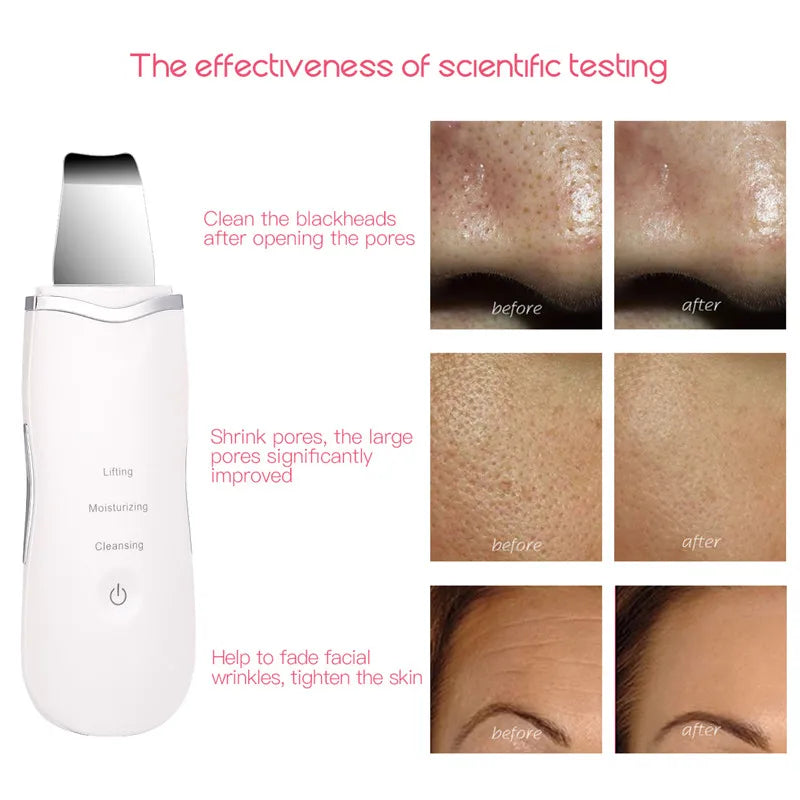 At Home Facial Ultrasonic Skin Spatula for Deep Cleaning and Blackheads - 8