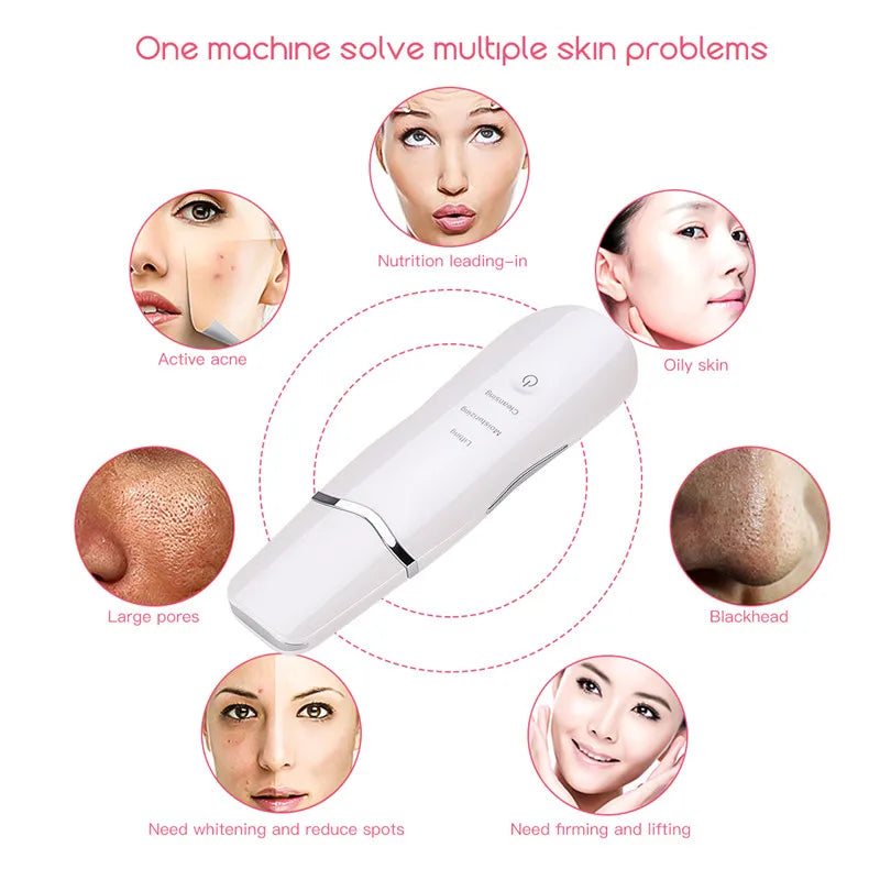 At Home Facial Ultrasonic Skin Spatula for Deep Cleaning and Blackheads - 10