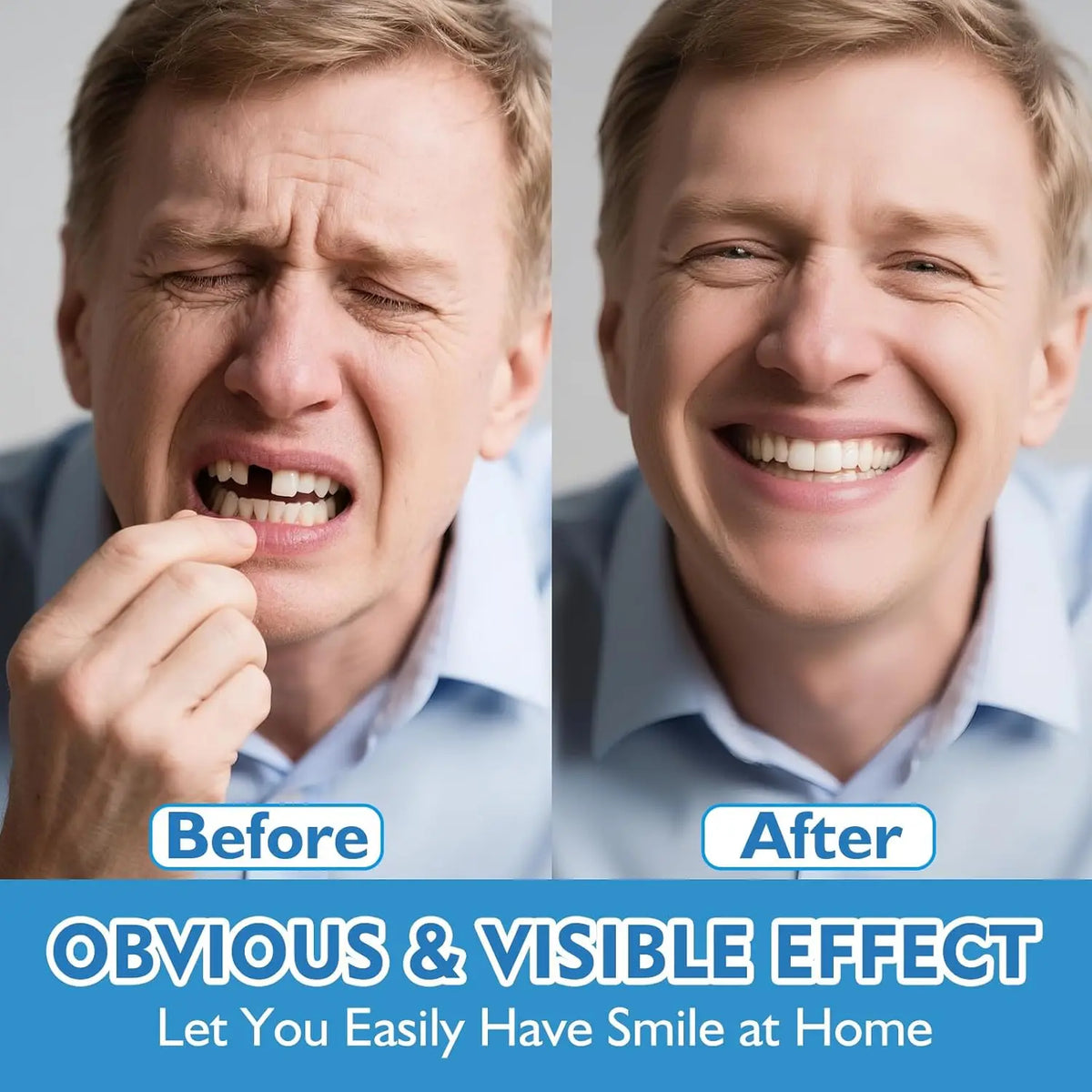 Daily Smile Snap-On Dentures for Instant Comfort and Natural Look