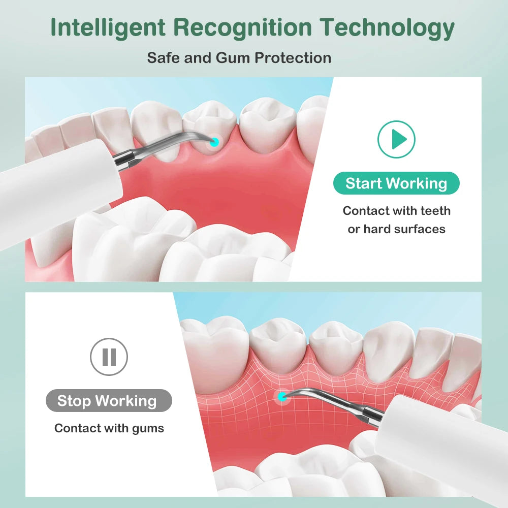 At home ultrasonic dental scaler for plaque and tartar removal - 2