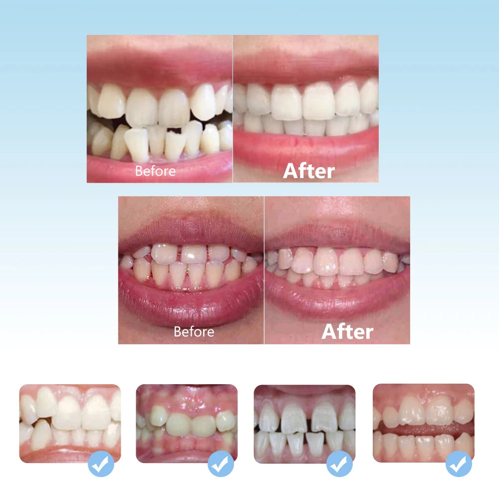 Kid teeth alignment dental trainer for home use - 7