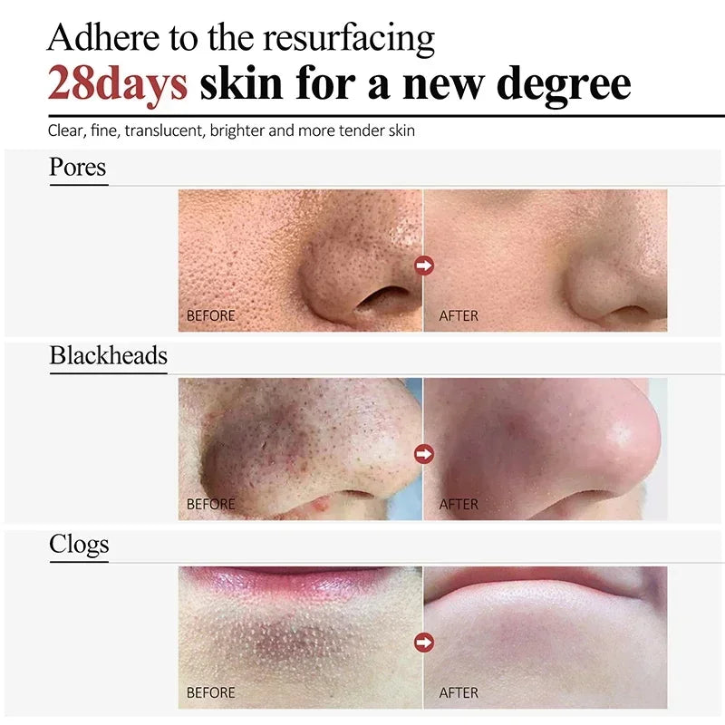 facial skin pore shrinking cream for smoother texture