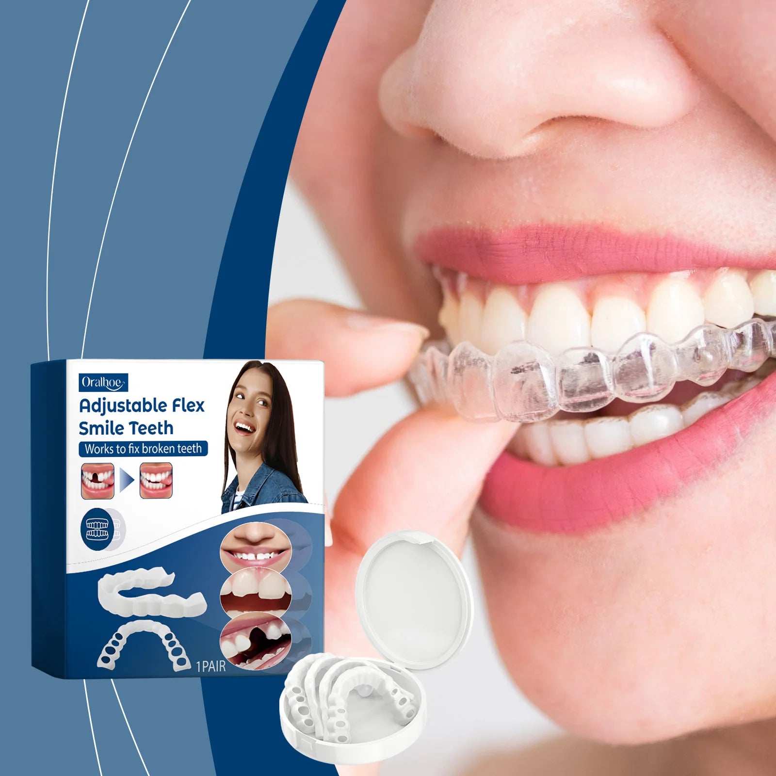 Missing Teeth Snap On Dentures For A Confident Smile And Perfect Fit - 2