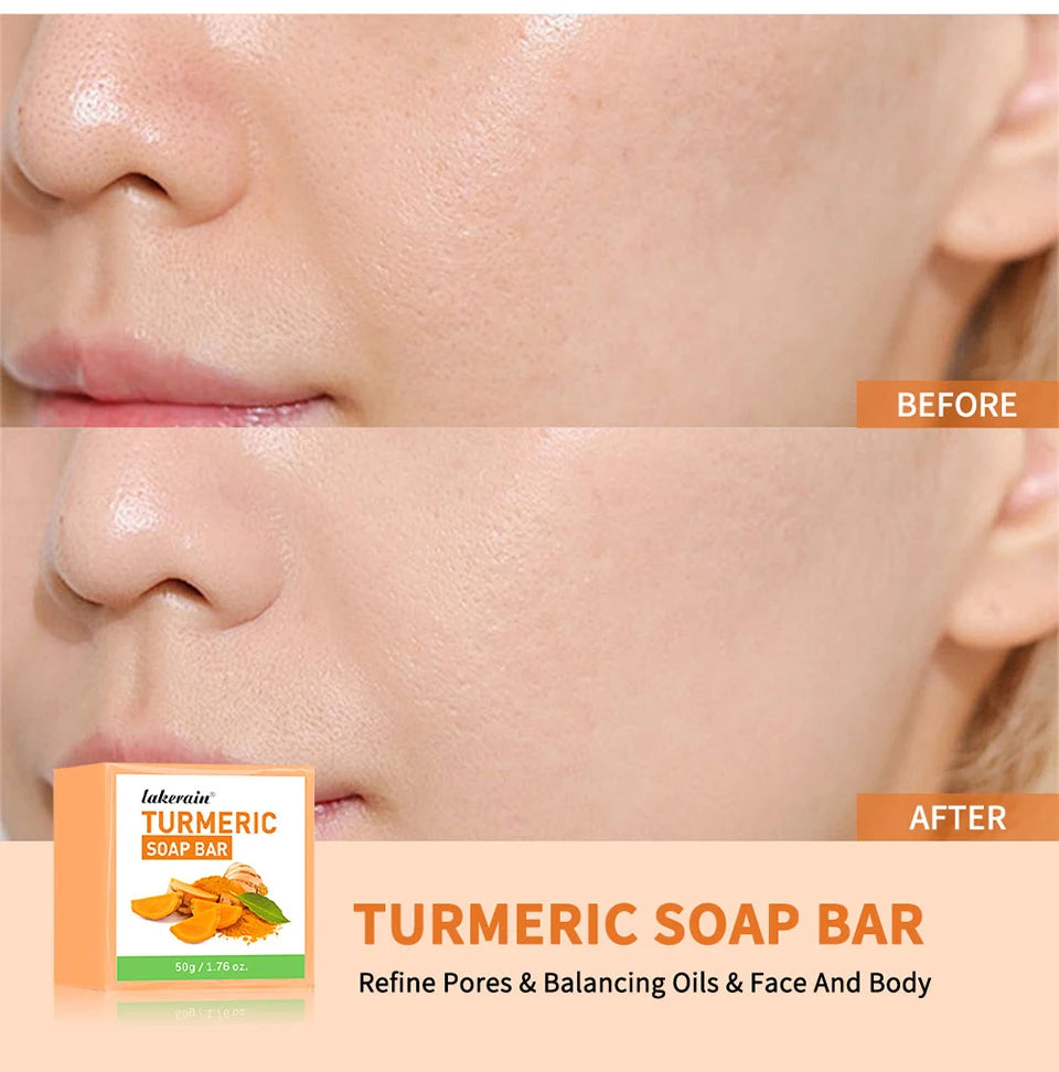 Daily Skincare Turmeric Soap Bar for Deep Cleaning Face and Body