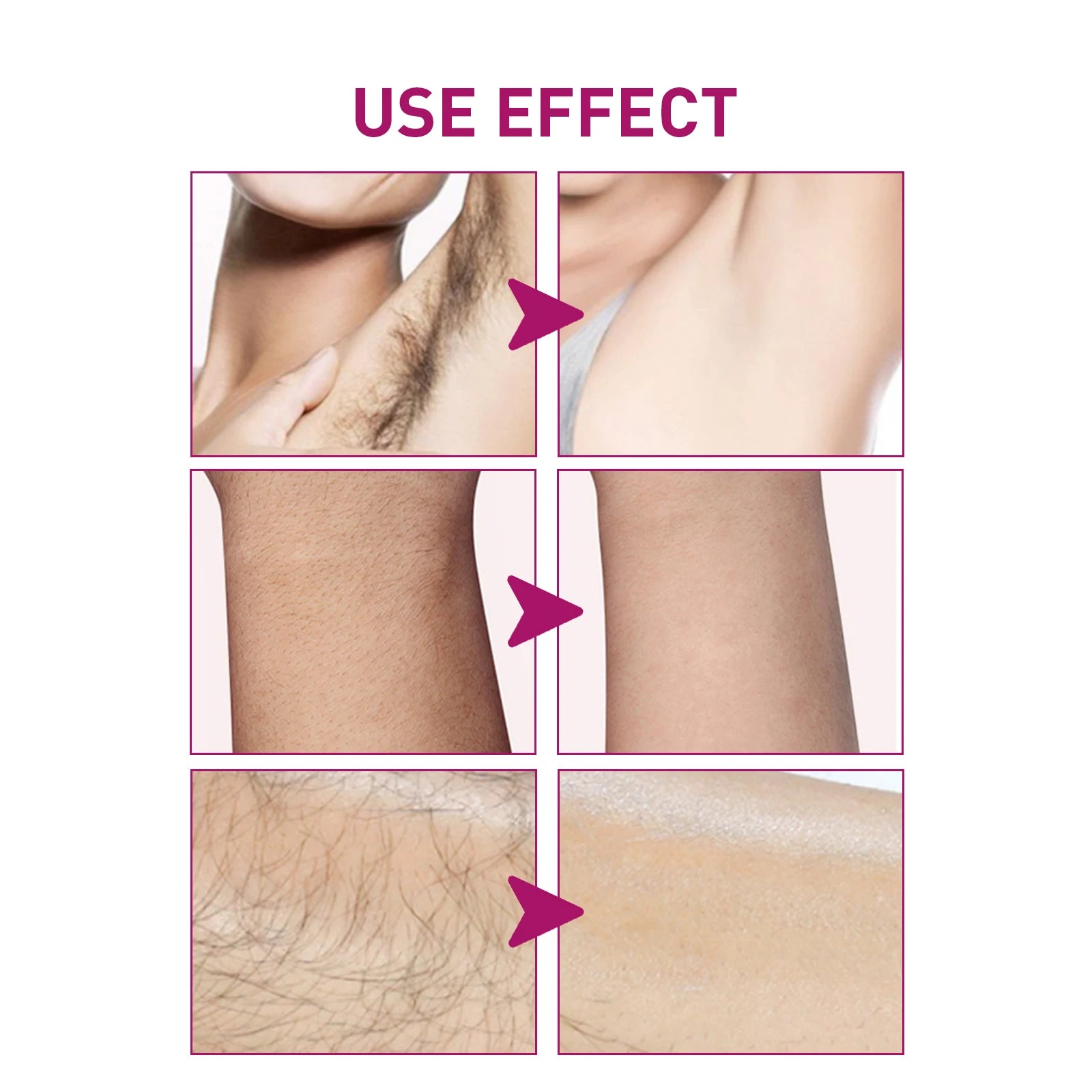 At Home Body Grooming Hair Removal Cream for Painless Soft Skin Care - 4