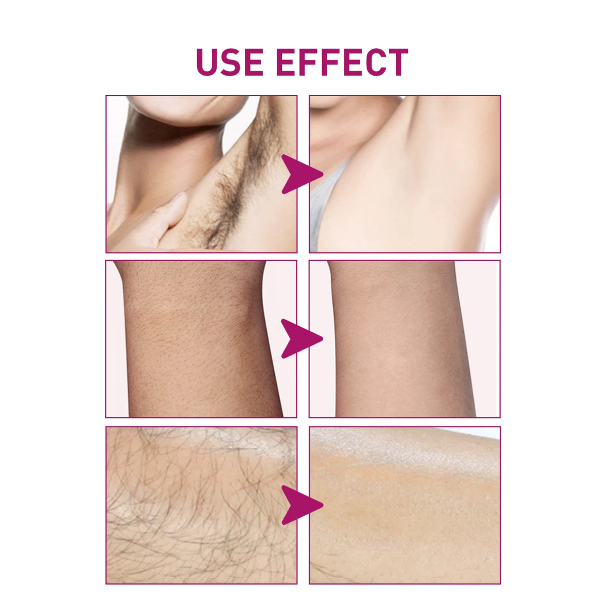 At Home Body Grooming Hair Removal Cream for Painless Soft Skin Care