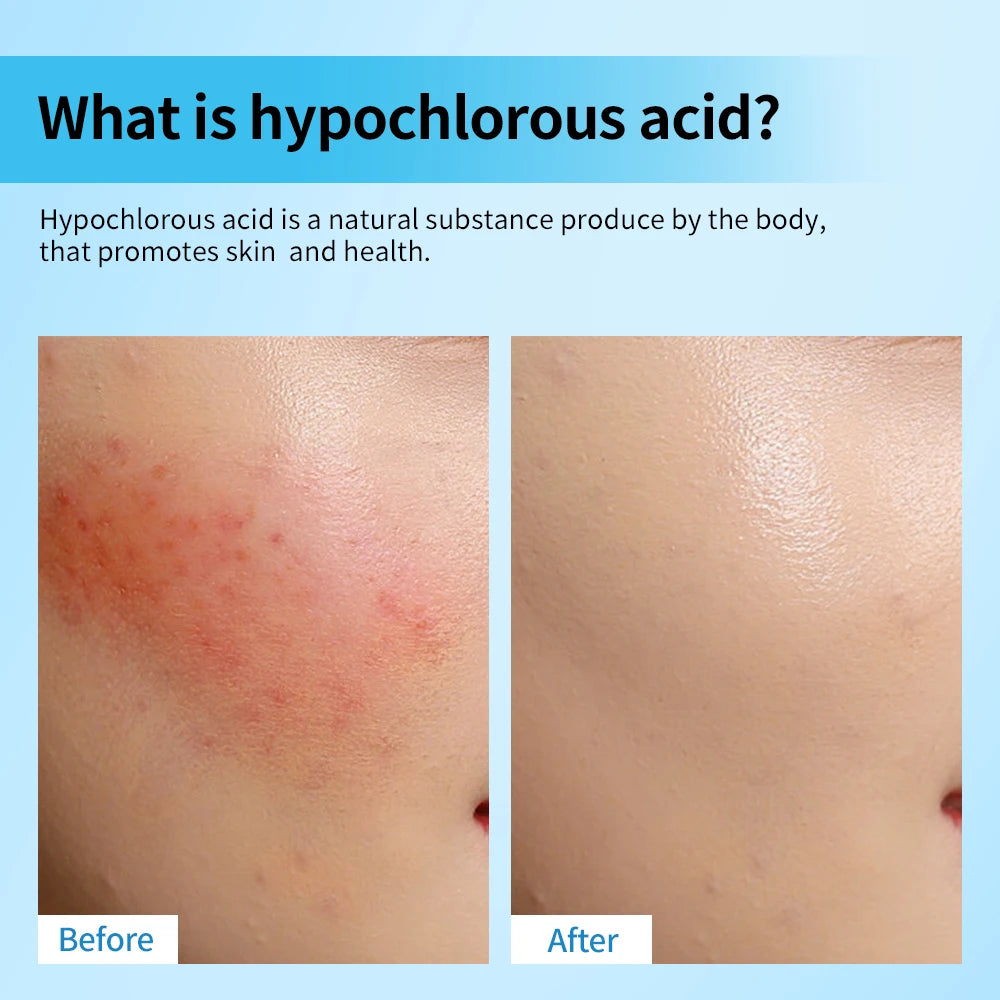 Daily skincare routine Hypochlorous Acid Facial Spray to calm redness - 3