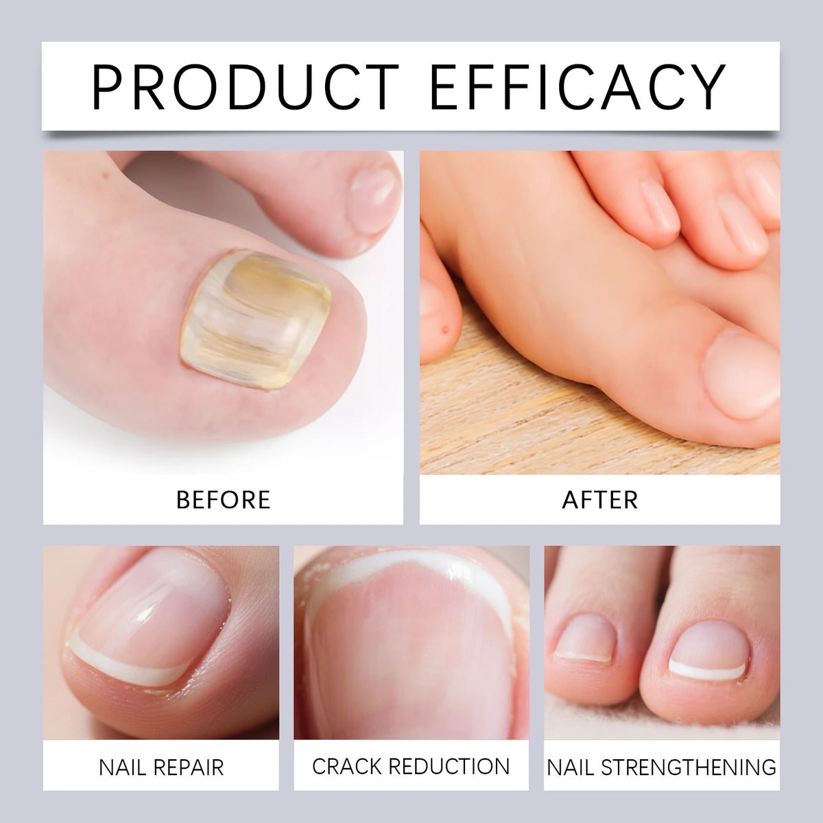 At home nail care cuticle oil pen to repair dry and fragile nails