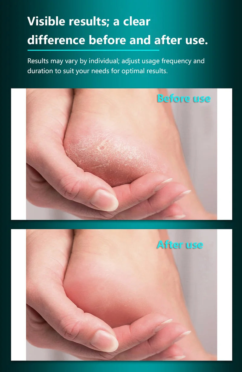 home pedicure care stainless steel foot file for cracked heels removal - 8