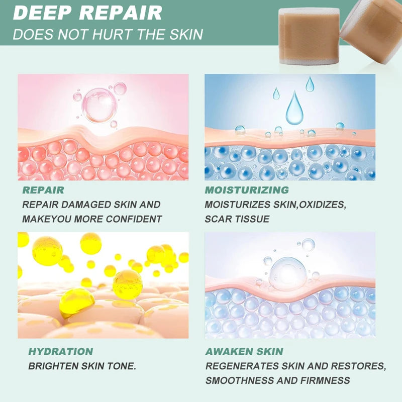Skin Care Silicone Gel Scar Patch for Invisible Scar Cover and Repair - 5