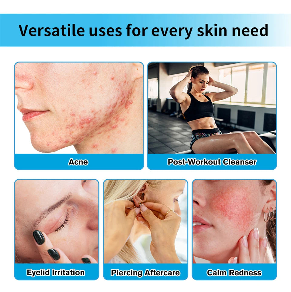 Daily skincare routine Hypochlorous Acid Facial Spray to calm redness