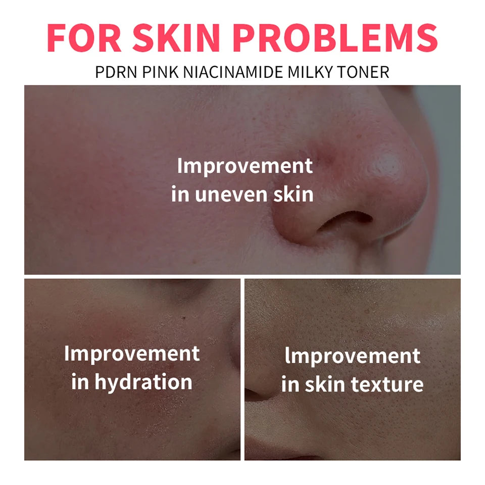 Daily Skincare PDRN Niacinamide Toner for Deep Hydration and Glow