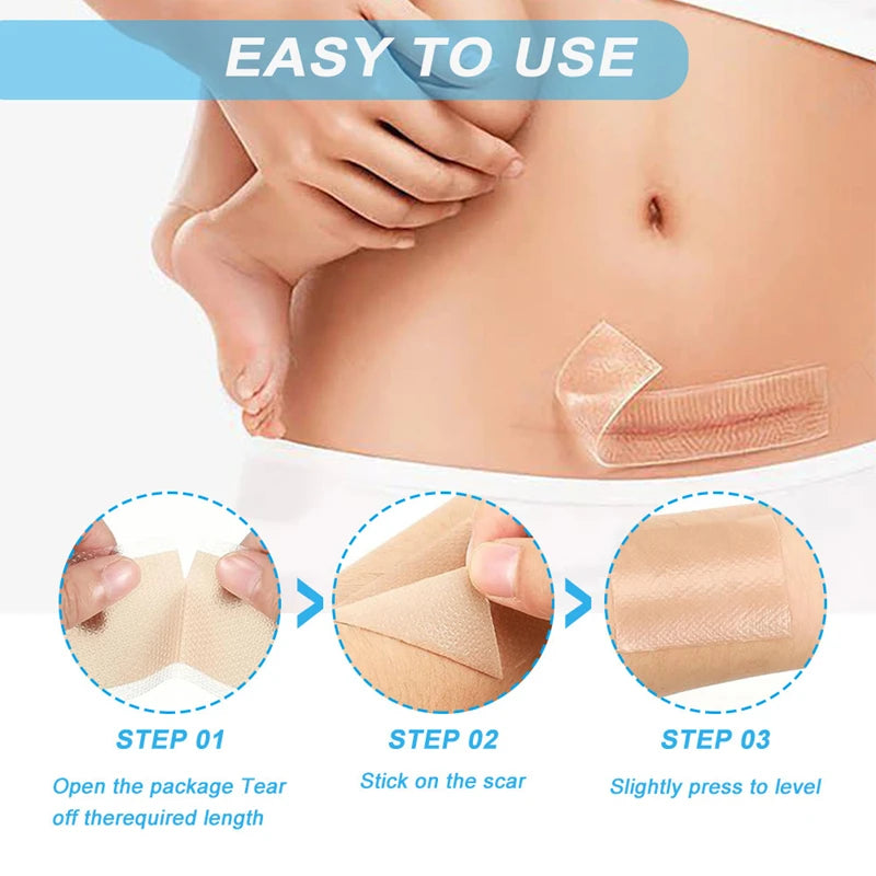 Skin Care Silicone Gel Scar Patch for Invisible Scar Cover and Repair - 2