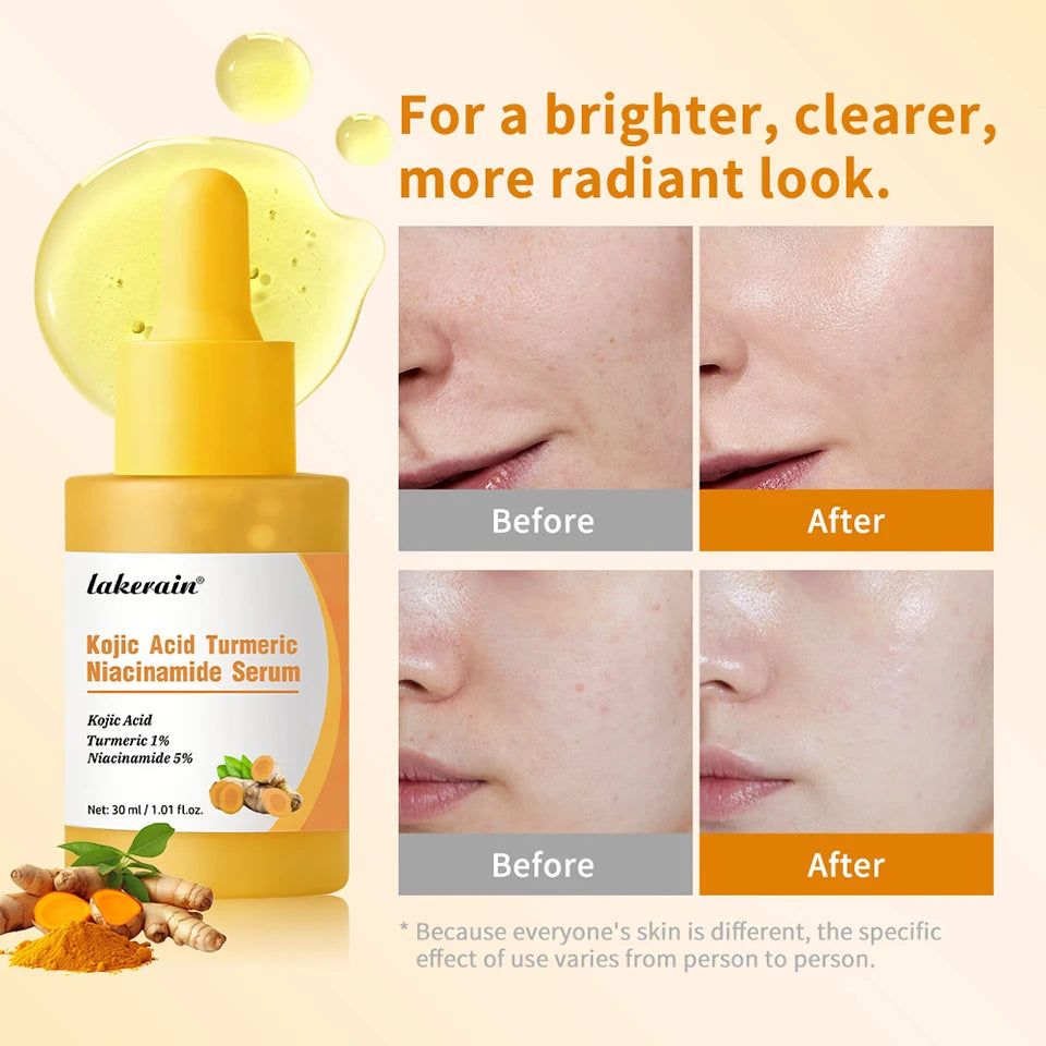 Face Skin Kojic Acid Turmeric Serum for Brightening and Hydration