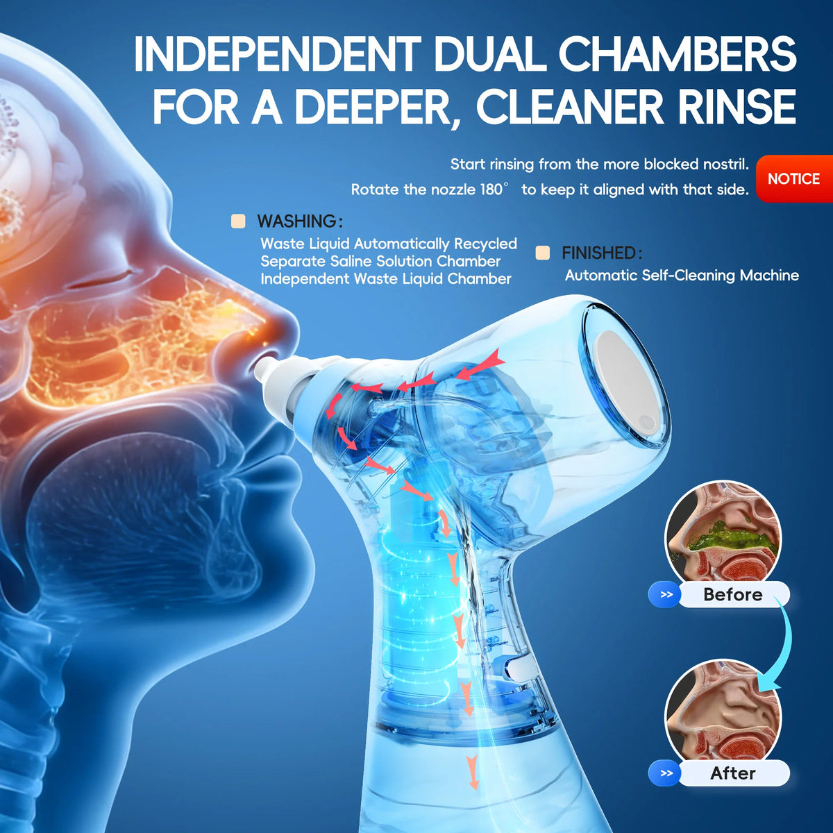 For Nasal Discomfort Electric Sinus Rinse Machine with Dual Water Tank