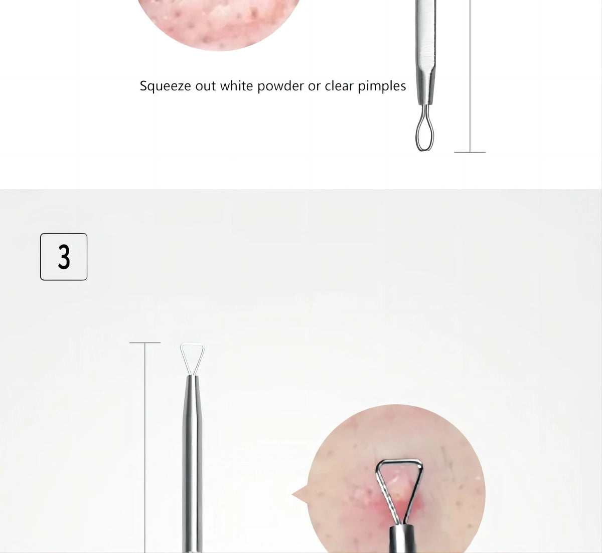 Bathroom mirror skin care 5PCS Blackhead Removal Kit for deep facial cleaning