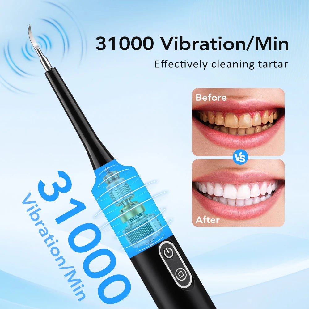 Bathroom Electric Dental Scaler for Tartar Removal and Teeth Whitening