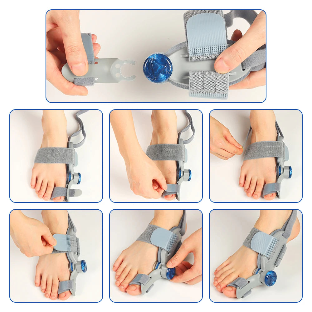 Home bunion adjuster brace with knob dial for comfortable toe alignment - 17