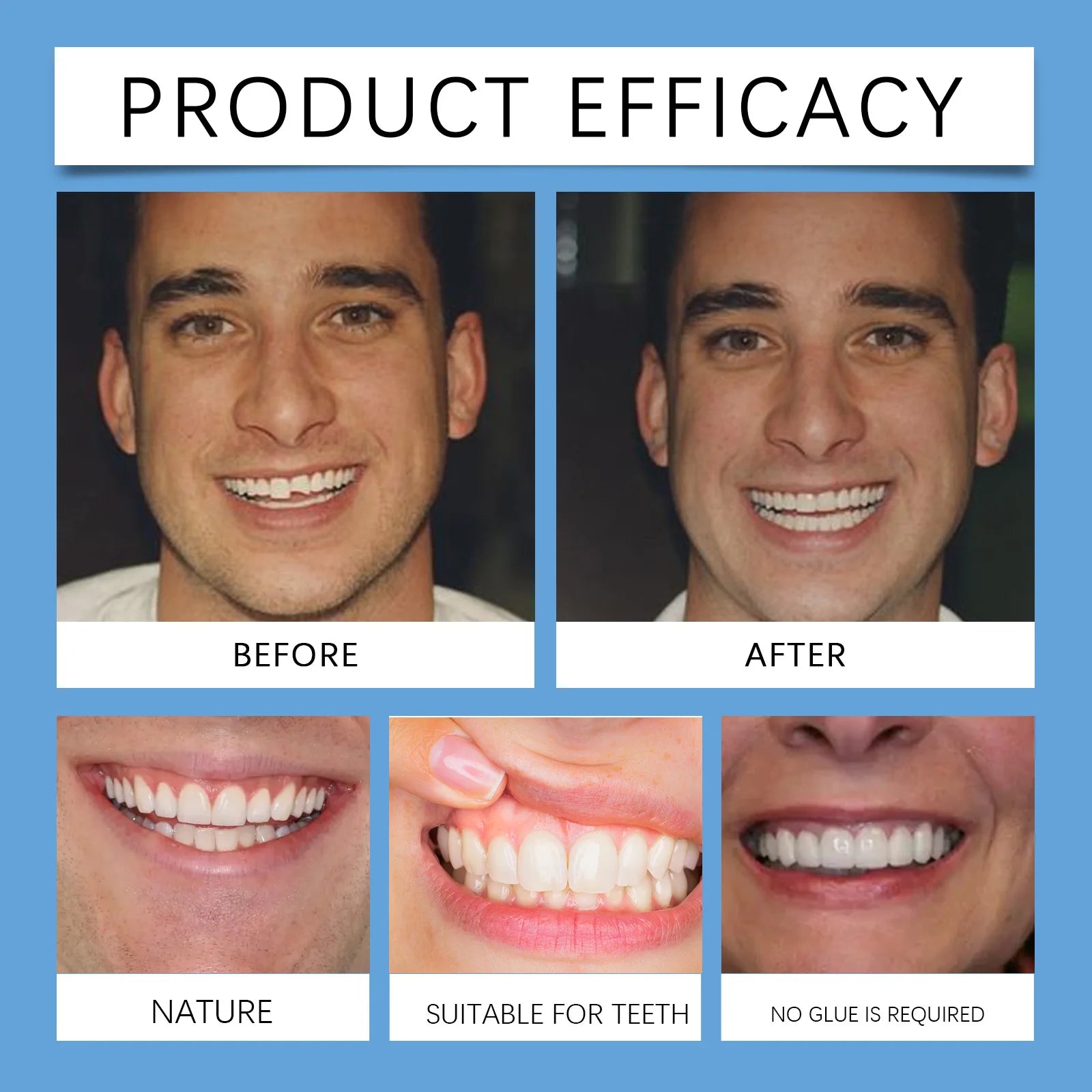Missing Teeth Snap On Dentures For A Confident Smile And Perfect Fit - 18