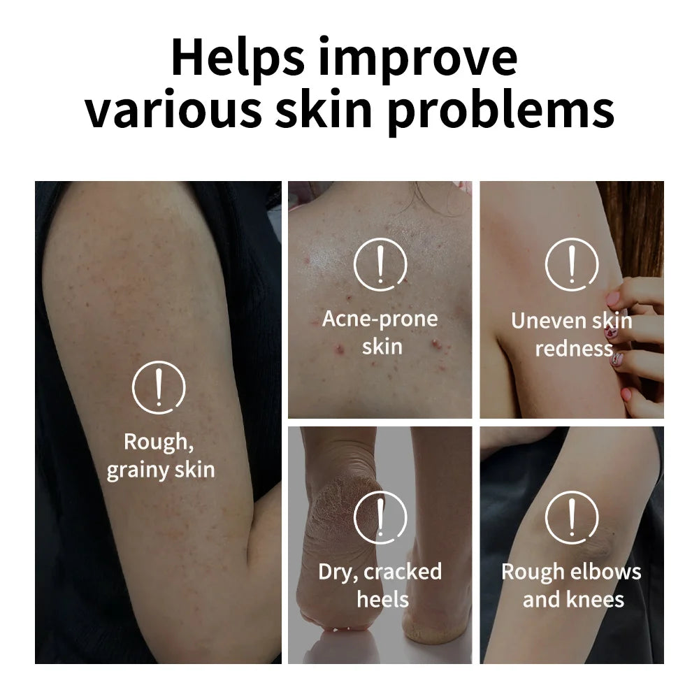 Dry skin care Glycolic Acid Exfoliating Body Stick for smooth skin