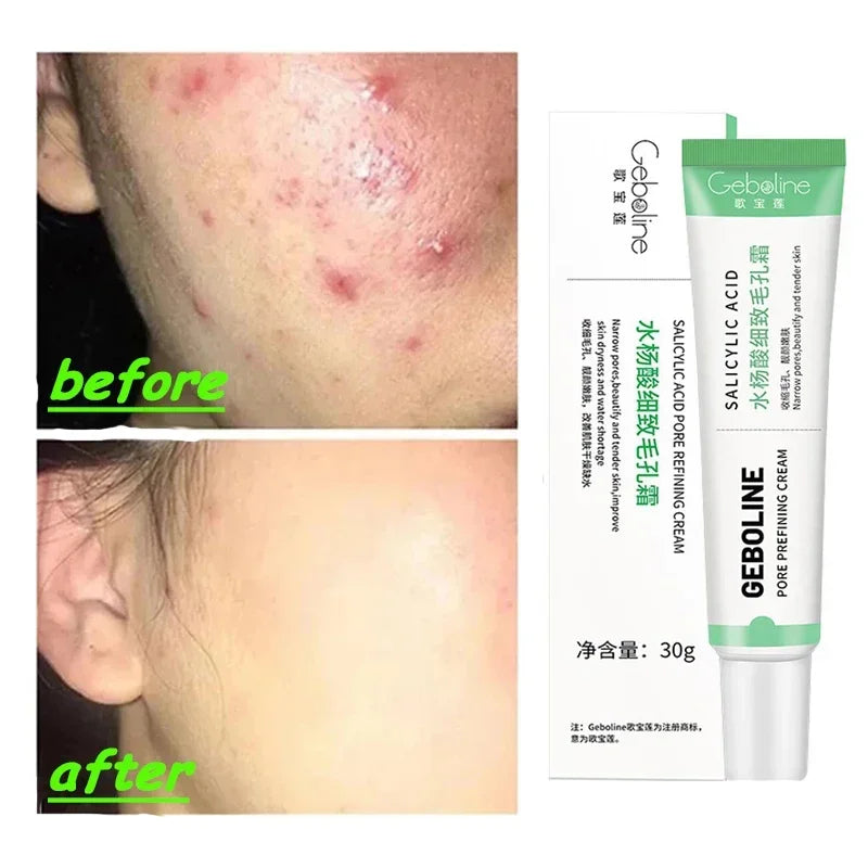 facial skin pore shrinking cream for smoother texture