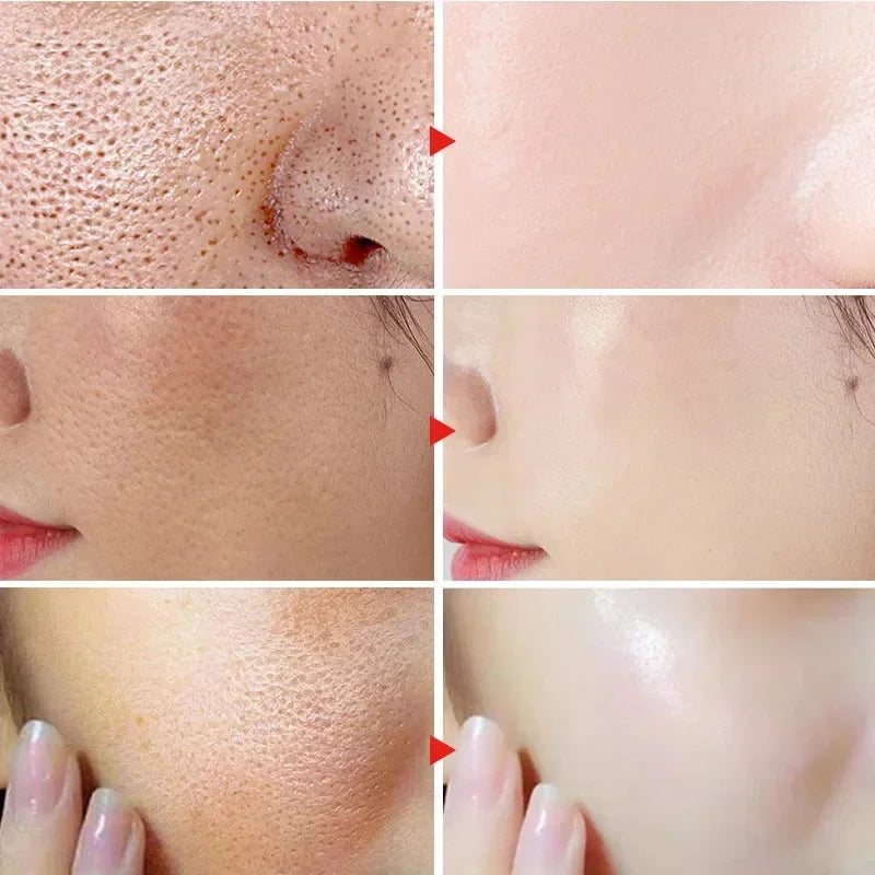 facial skin pore shrinking cream for smoother texture