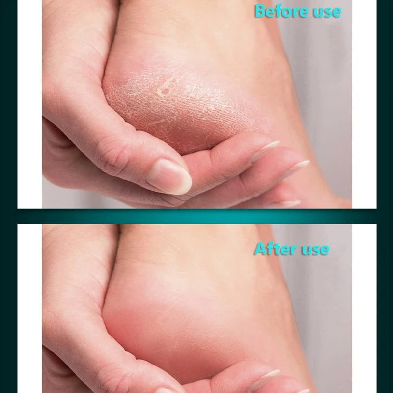 home pedicure care stainless steel foot file for cracked heels removal