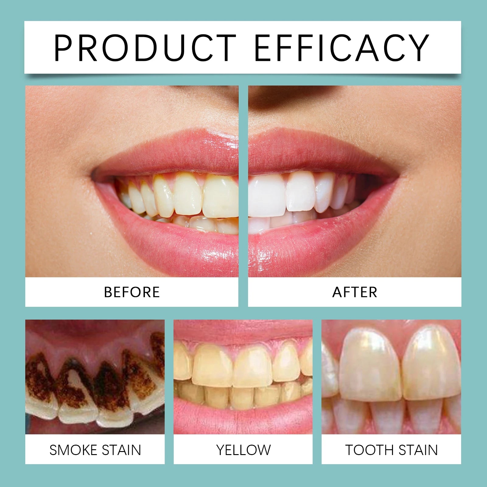 Brighten Your Smile With Professional Teeth Whitening Paint Gel - 11