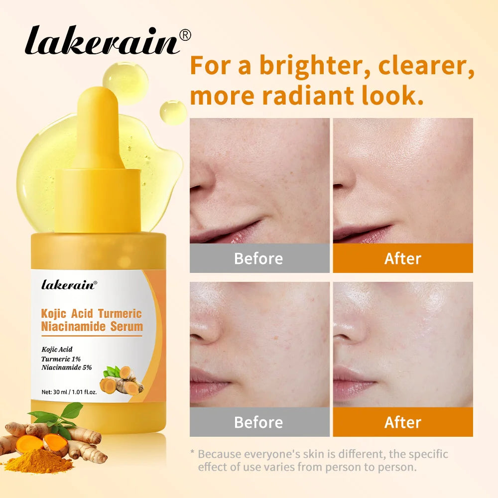 Face Skin Kojic Acid Turmeric Serum for Brightening and Hydration - 4