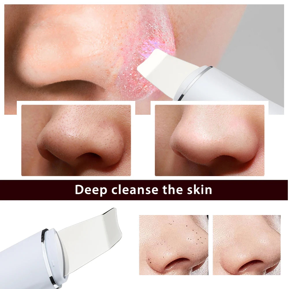 At home face care ultrasonic skin scrubber for deep pore cleaning