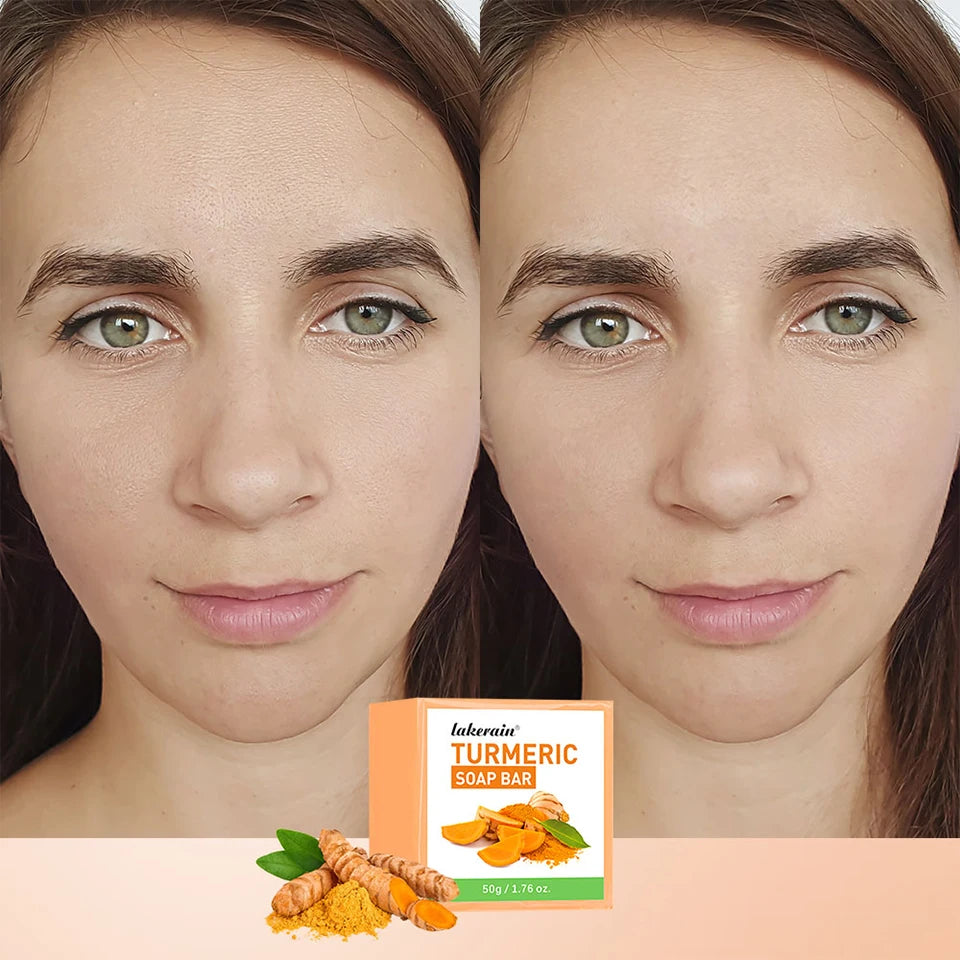 Daily Skincare Turmeric Soap Bar for Deep Cleaning Face and Body