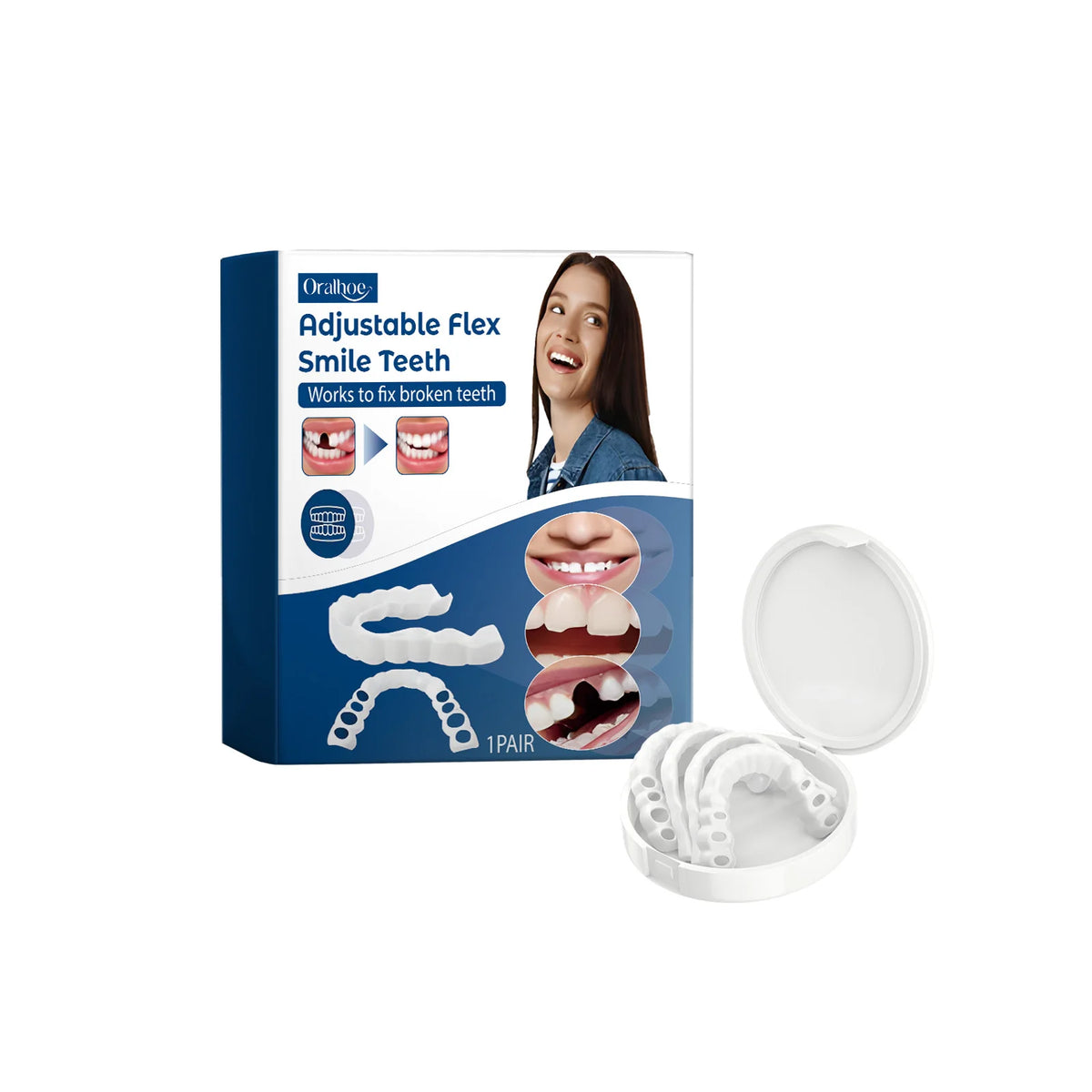 Missing Teeth Snap On Dentures For A Confident Smile And Perfect Fit