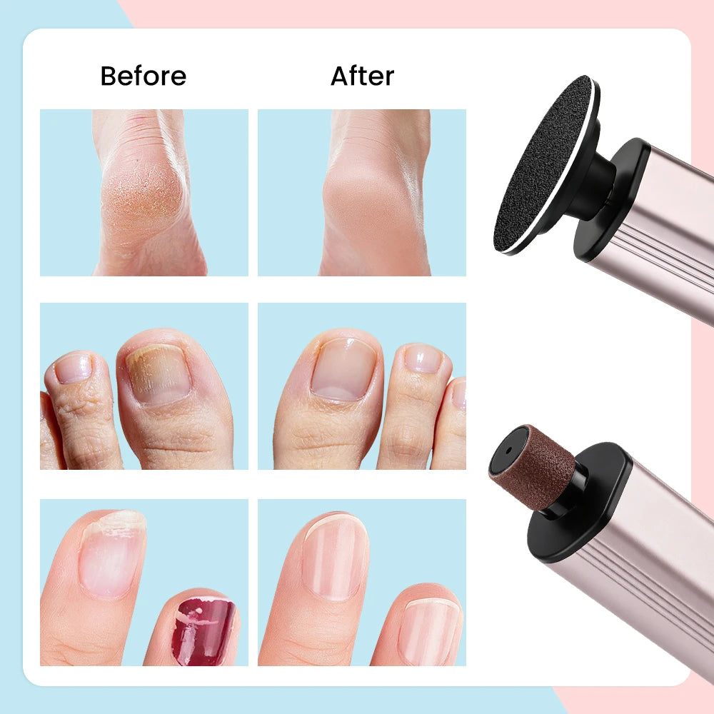 At Home Heel Care Electric Foot File Callus Remover for Smooth Feet - 12