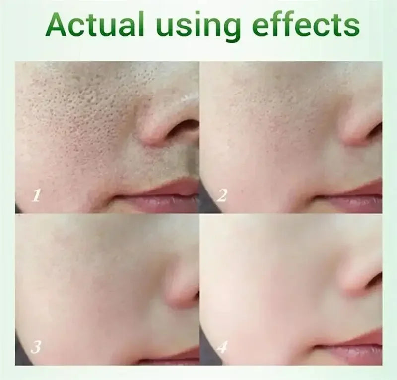 facial skin pore shrinking cream for smoother texture