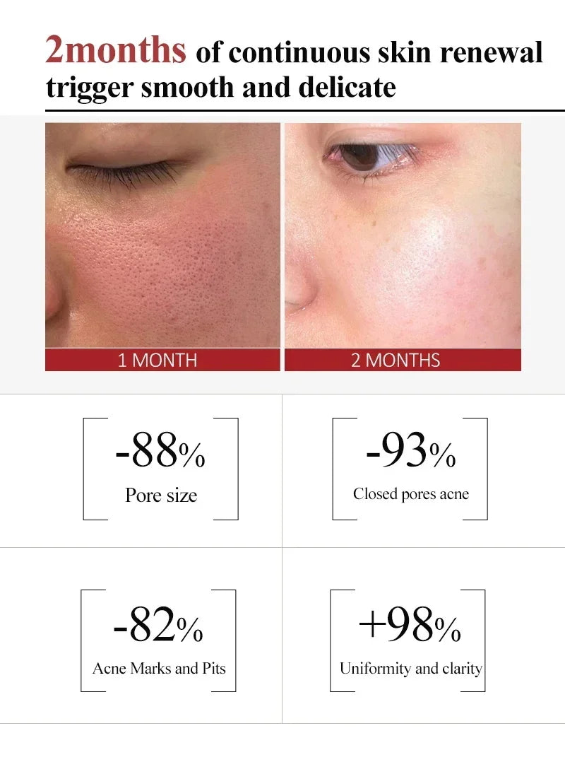 facial skin pore shrinking cream for smoother texture