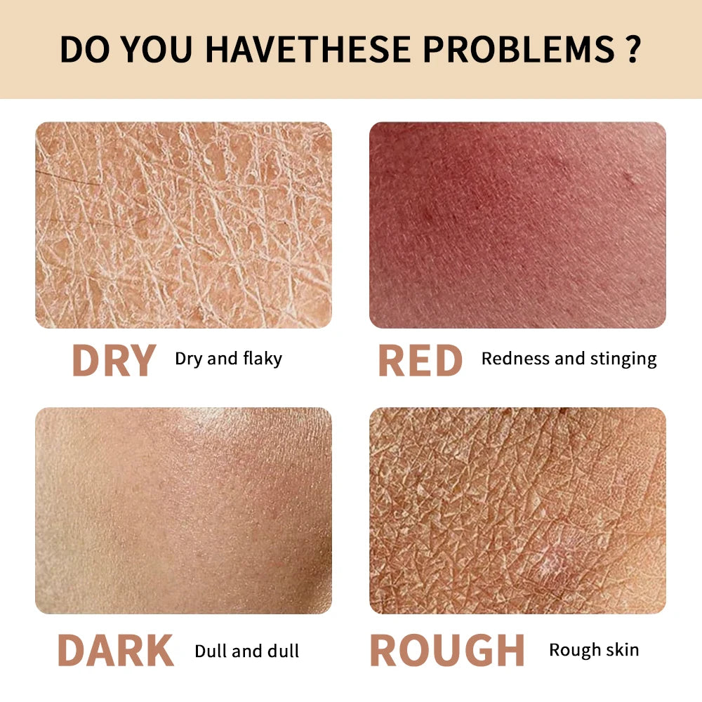 Daily Skincare Lakerain Hydrogel Cream Deeply Nourishing Face Skin Care