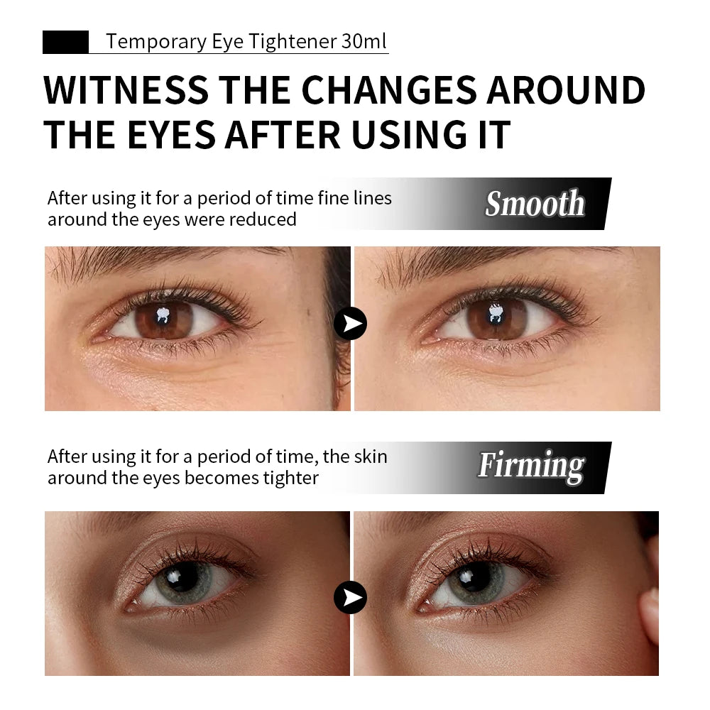 Daily eye care Temporary Eye Tightener for smooth skin - 5