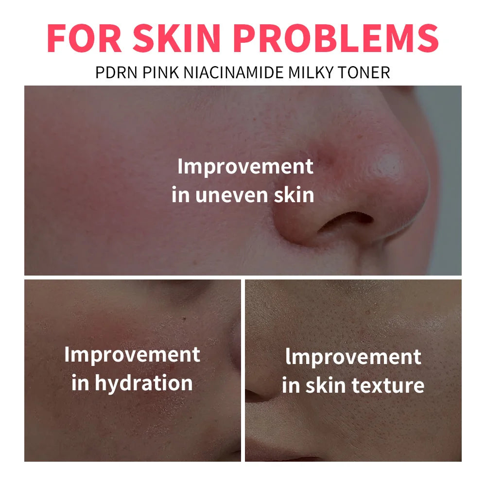 Daily Skincare PDRN Niacinamide Toner for Deep Moisture and Glowing Skin