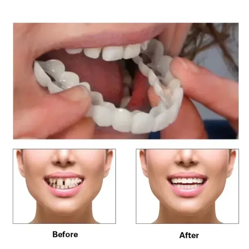 Daily Smile Enhancement Denture Silicone Kit for Easy Fit - 1