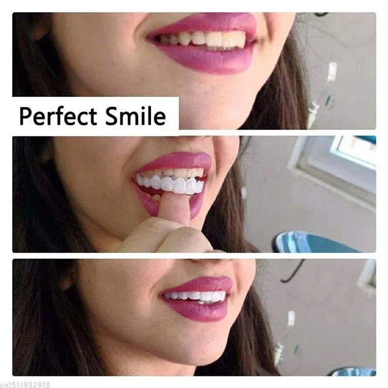 Daily Smile Veneer Snap-on Teeth Kit for Temporary Tooth Replacement - 9