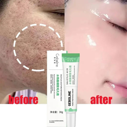 facial skin pore shrinking cream for smoother texture