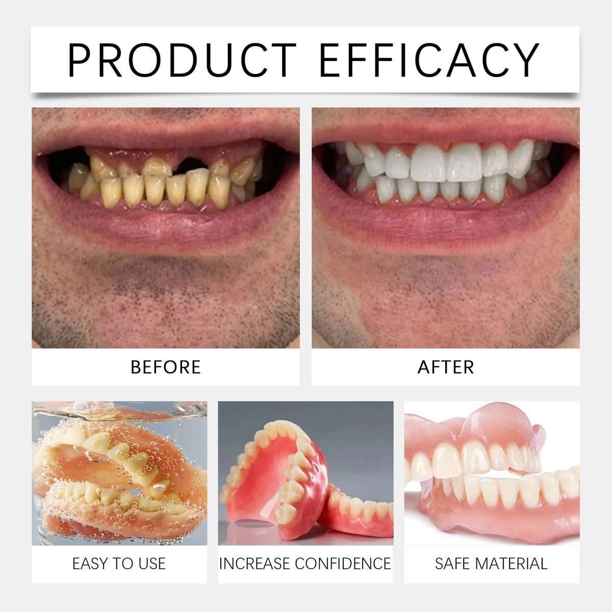 Daily Smile Soft Silicone Denture Kit For Natural Missing Teeth Repair