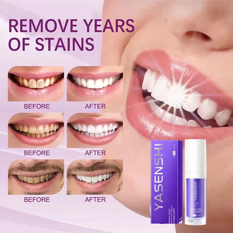 Daily Dental Care Whitening Toothpaste for Fresh Breath and Bright Smile - 2