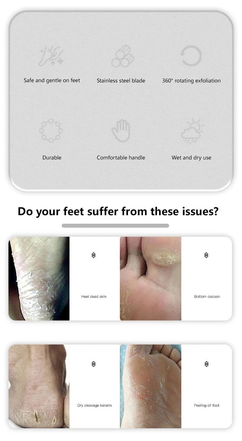 home pedicure care stainless steel foot file for cracked heels removal - 9