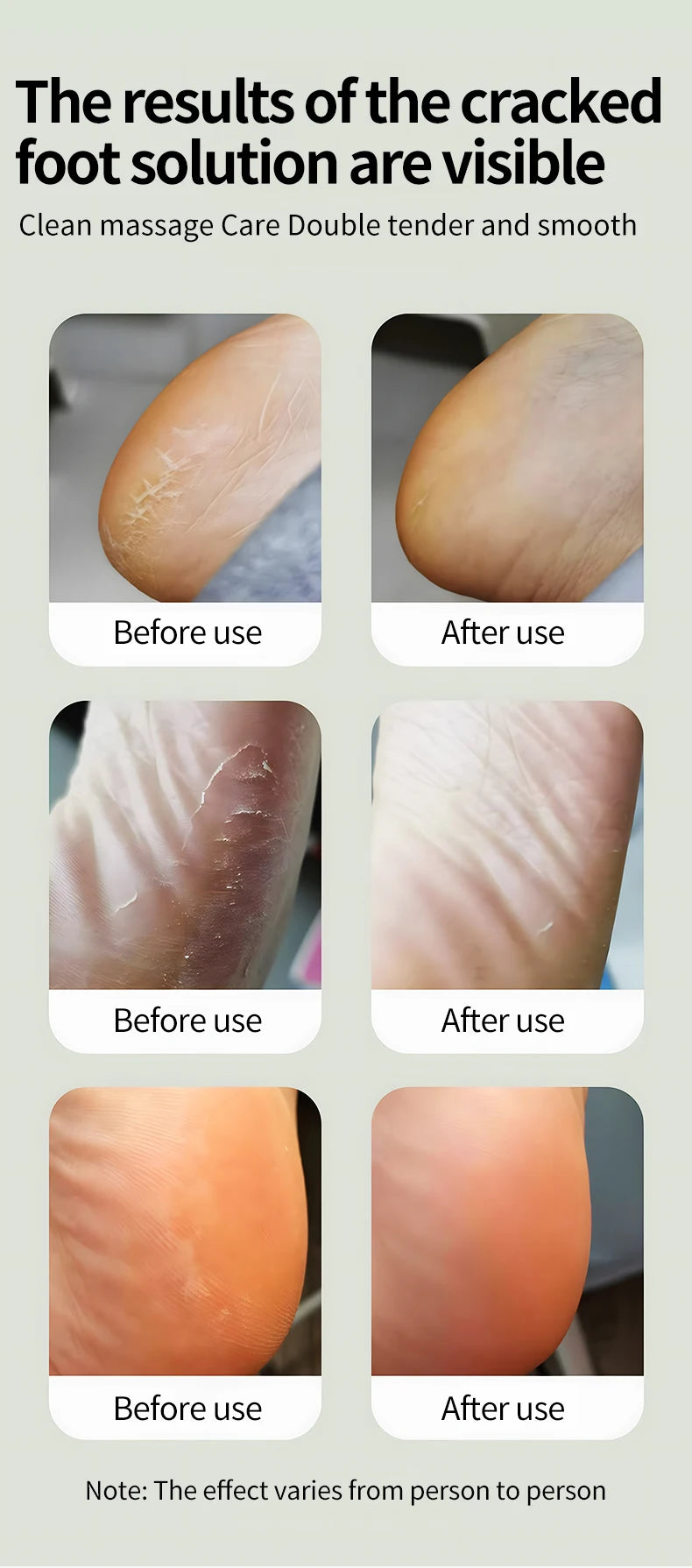 At Home Foot Care Cordless Electric Foot Callus Remover for Soft Heels - 10