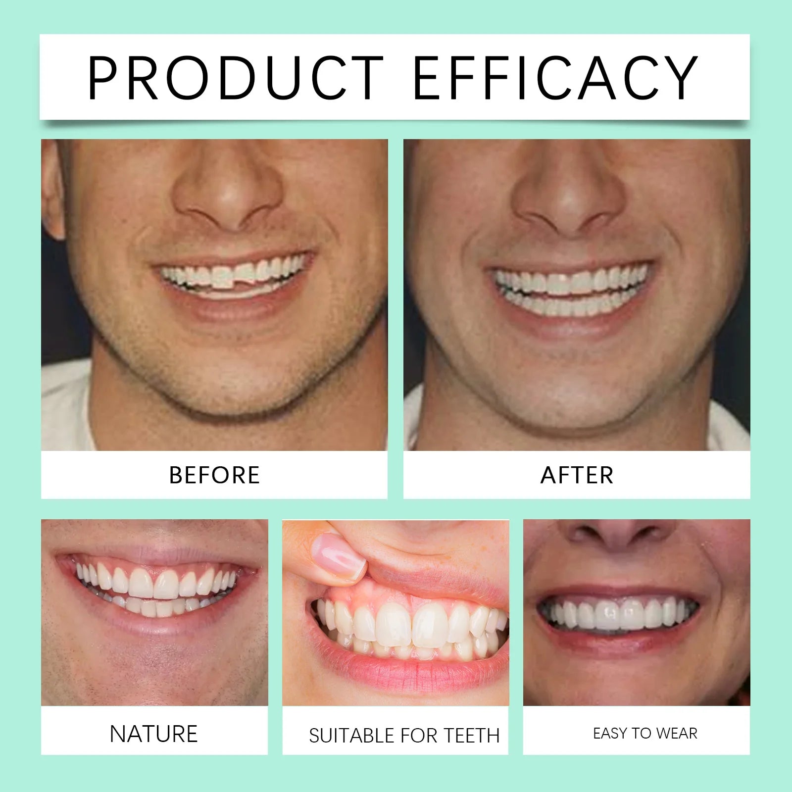 Daily Smile Recovery Silicone Dentures Set for Natural Look and Fit - 12
