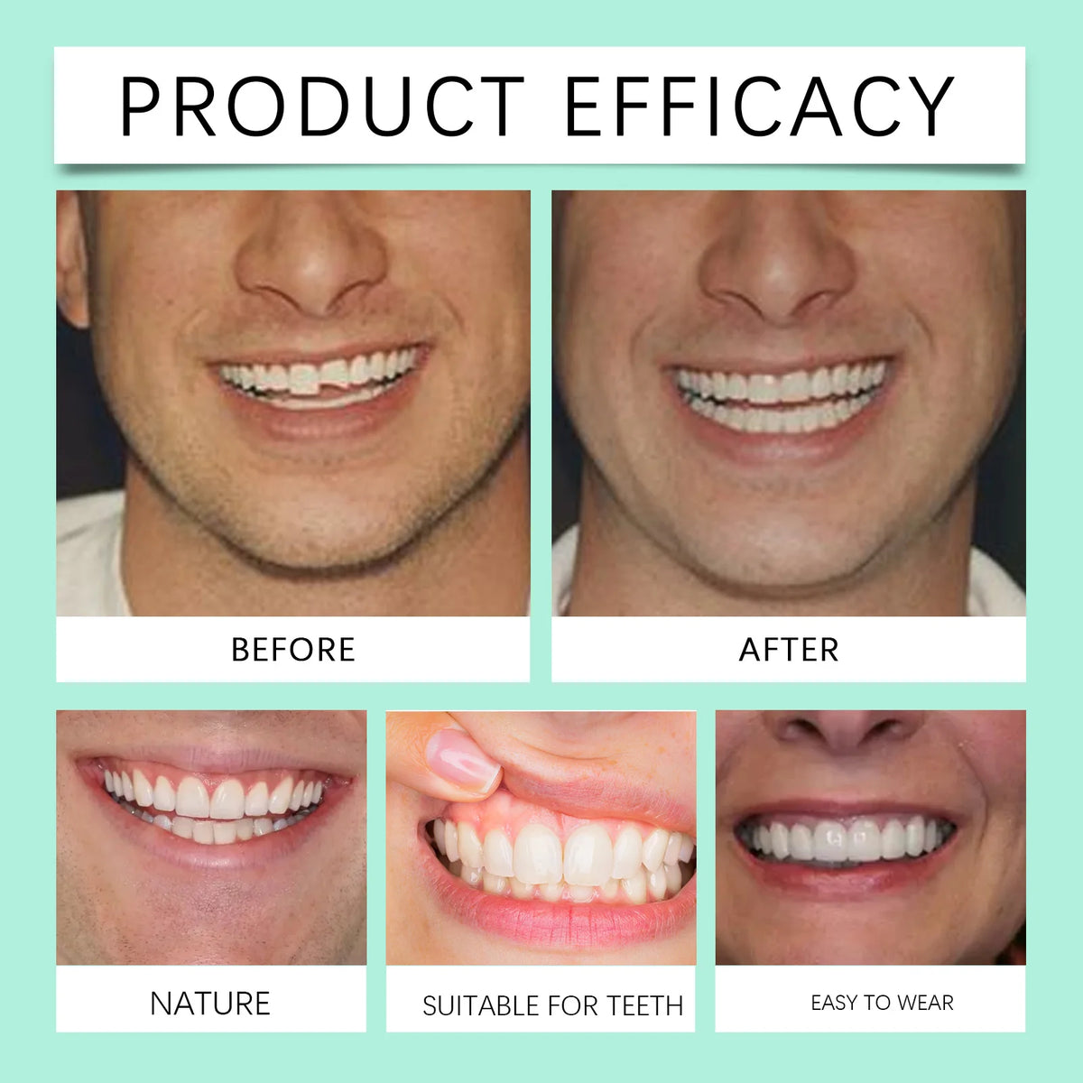 Daily Smile Recovery Silicone Dentures Set for Natural Look and Fit