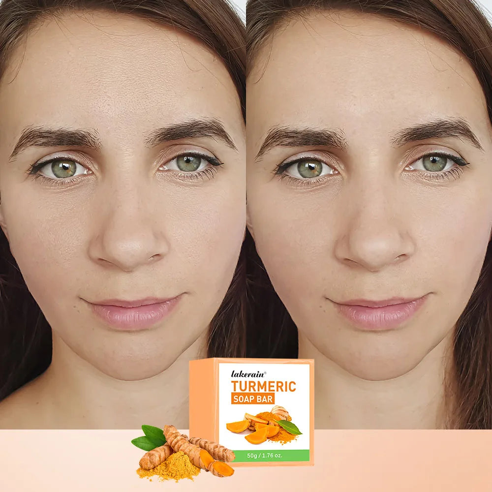 Daily Skincare Turmeric Soap Bar for Deep Cleaning Face and Body - 3